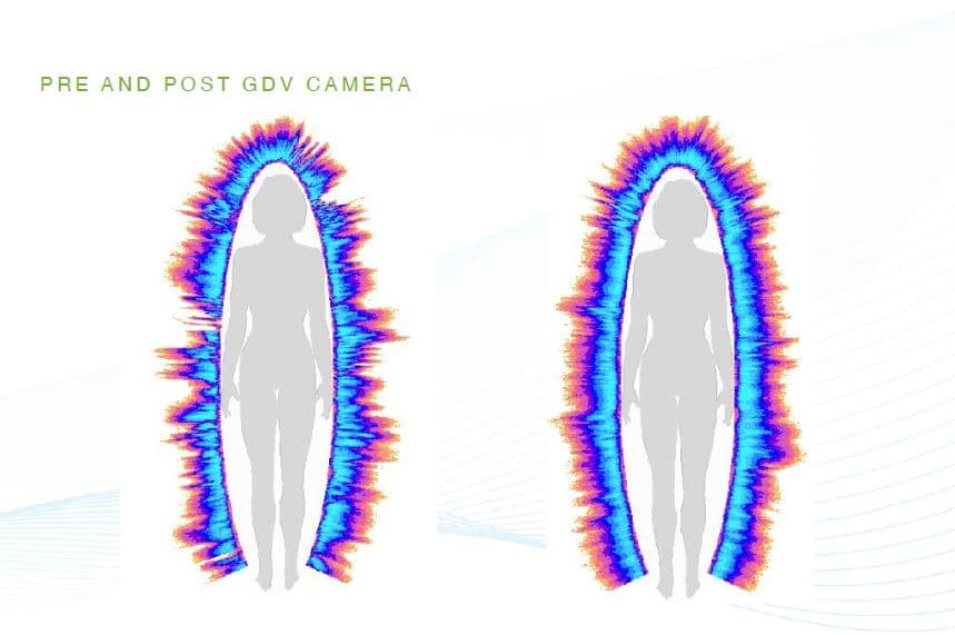 Pre and Post GDV Camera aura reading